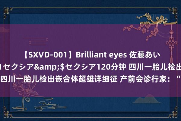 【SXVD-001】Brilliant eyes 佐藤あい</a>2006-11-01セクシア&$セクシア120分钟 四川一胎儿检出嵌合体超雄详细征 产前会诊行家：“超雄”≠“天生坏种”